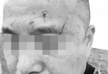 女醫(yī)生稱因不會宰病人被領(lǐng)導(dǎo)打 院長：她先動手