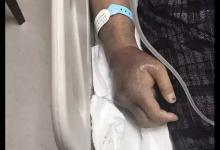 廈大回應(yīng)附屬醫(yī)院院長博士論文抄襲：學(xué)術(shù)不端，不構(gòu)成剽竊