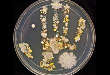 “夫妻相”如何形成？因夫妻微生物生態(tài)環(huán)境接近