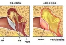 寧波22歲小伙的聽力相當于90歲老人！竟然是因這個習慣…看完想扔手機