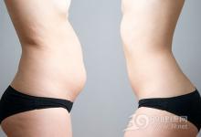 體重正常就健康？有小肚子早死風(fēng)險(xiǎn)大