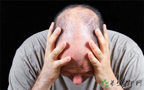 8000人報名脫發(fā)志愿者 脫發(fā)的原因有哪些