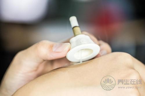 艾艾貼艾灸器：知名養(yǎng)生節(jié)目都在講它，連《向往的生活》里都有它