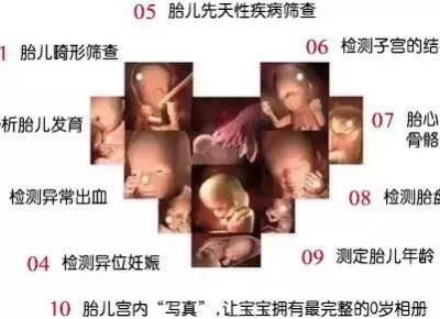 唐山寶島婦兒醫院：四維彩超檢查什么有哪些注意事項？