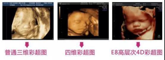 懷了雙胞胎又驚喜又擔憂，唐山寶島婦兒醫院為您保駕護航