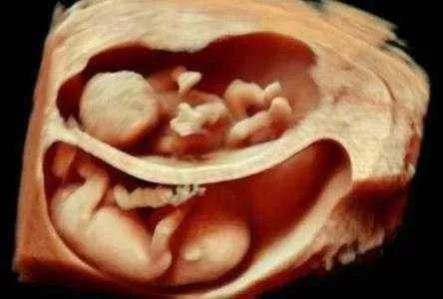 懷了雙胞胎又驚喜又擔憂，唐山寶島婦兒醫院為您保駕護航