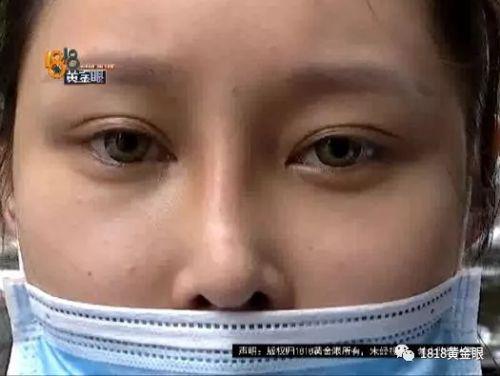 三女子整容均出現不同程度歪斜 義烏陽光美容醫院：本身就有問題