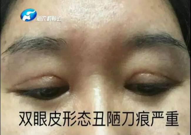 女子整形失敗 許昌華姿醫美整形醫院不認：因為醫生已離職