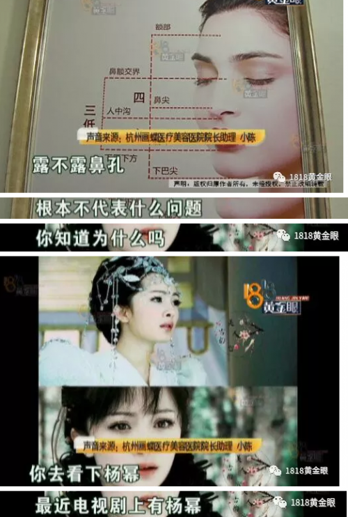 杭州畫蝶醫療美容醫院做整形 鼻子沒做好做成了豬頭鼻