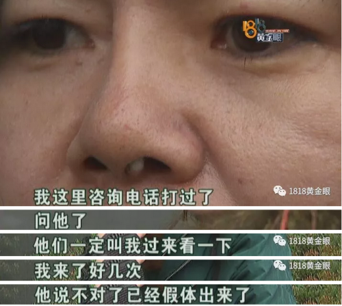 六年前在寧波珈禾整形專科醫院做隆鼻 現在鼻子不舒服露出白色假體-易網<a href=http://www.logojc.com/ target=_blank class=infotextkey>健康養生</a>網 六年前在寧波珈禾整形專科醫院做隆鼻 現在鼻子不舒服露出白色假體