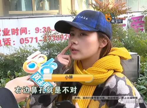 杭州愛琴海醫(yī)療美容醫(yī)院整鼻后鼻孔不對稱 朋友看到都不敢做了