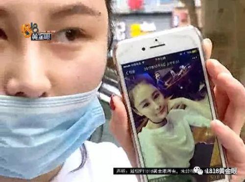 三女子整容均出現不同程度歪斜 義烏陽光美容醫院：本身就有問題