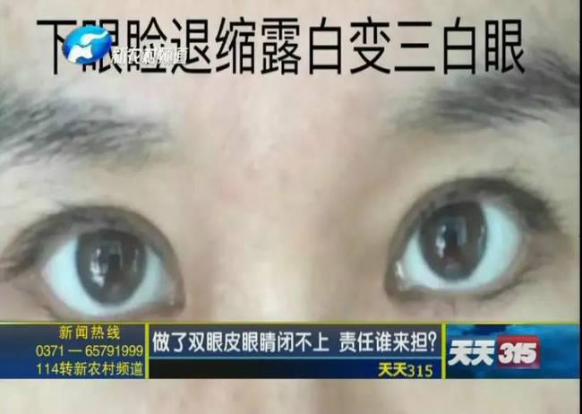 女子整形失敗 許昌華姿醫美整形醫院不認：因為醫生已離職