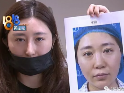 韓國籍名醫(yī)、萬元美容針——高端美容竟是“三無”騙局