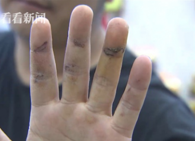 通州灣三余人民醫院為男病人配婦科用藥？院方：拿錯了