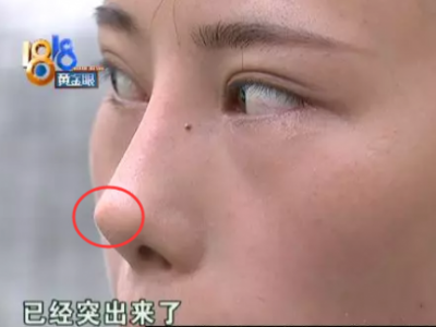 江蘇6兒童敷“三伏貼”出現(xiàn)不良反應(yīng) 涉事醫(yī)生被指非法行醫(yī)