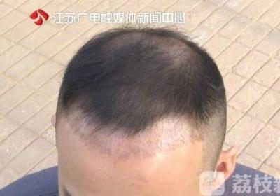 南寧華美醫院打“水光針”后悲劇了 醫生還未取得執業醫生資格證