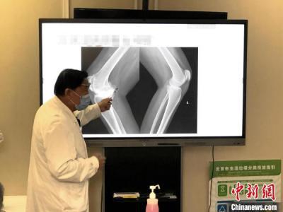 大骨節(jié)病公益項(xiàng)目：已為西藏244位大骨節(jié)病患者進(jìn)行關(guān)節(jié)置換手術(shù)