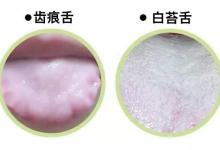 每天蒸飯放一把，遠離三高、心臟病、拒絕癌癥