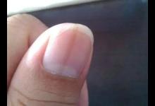 指甲已經發出健康預警了，你還蒙在鼓里！