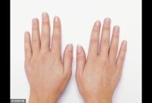 指甲已經(jīng)發(fā)出健康預(yù)警了，你還蒙在鼓里