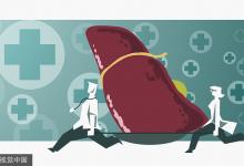 肝病早期不痛不癢，出現(xiàn)疼痛就晚了，若有4癥狀要檢查