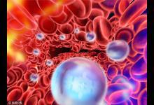 5種壞習(xí)慣最傷血管 7個癥狀說明你的血管堵了