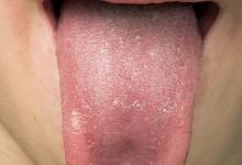 早秋祛濕不用愁，讓我們輕松解決它