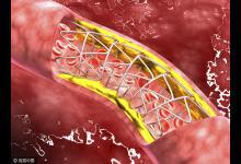 血管堵了，全身遭殃，這個動作讓全身血液流通起來