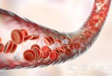 10秒鐘“清理”你的血管，血栓最怕這個動作，躺著就能做