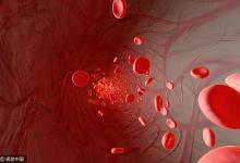 92歲老人血管壁光滑如29歲小年輕，只因吃它