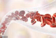 此時(shí)是血管保養(yǎng)最關(guān)鍵的時(shí)期！多吃它血管永年輕