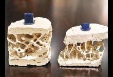 養骨就學這4個秘訣 提早儲備骨骼“銀行”