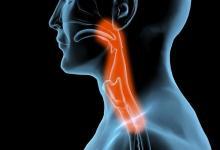 總是想清嗓子是怎么回事？ 保護嗓子有絕招