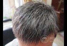 3種食物吃太多,白發(fā)、掉發(fā)就會找上門!