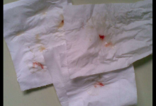 咽喉有痰是什么原因