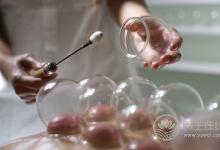 拔火罐的三大禁忌你知幾個(gè)?