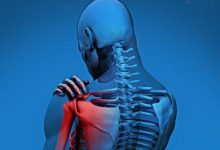 如何預(yù)防骨質(zhì)增生