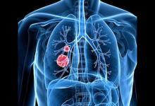 長期吃梨有潤肺止咳的功效嗎？