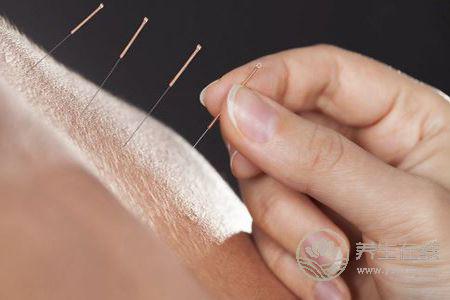 針灸減肥效果好不好呢