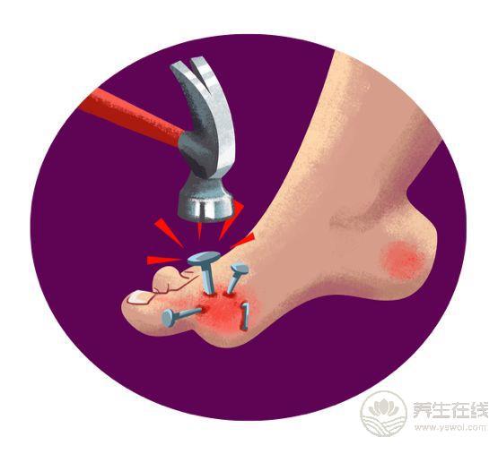 尿酸高的人注意，這3類食物碰多了，腎會“壞掉”！