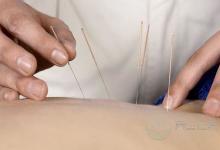 針灸減肥效果好不好呢