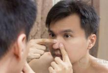 假期飲食不當竟會惹上皮膚病？節后調理身體需注意4點