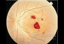這兩類食物很毒，最容易導(dǎo)致肝癌，很多人還不注意
