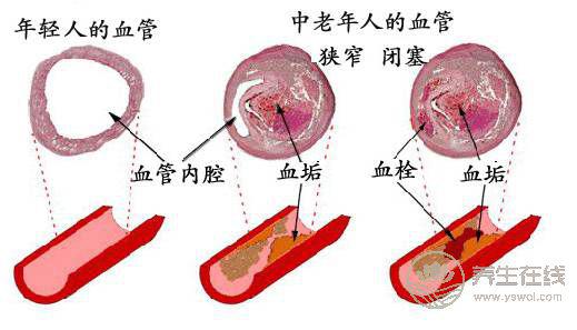 7種“換血”食物，每天吃一種身體棒棒的！
