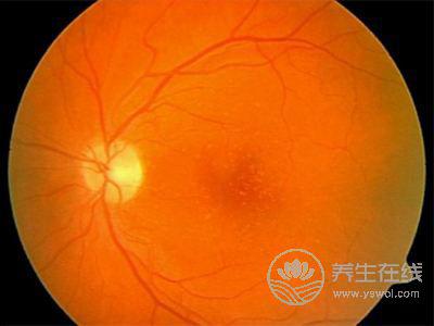 黃斑變性的食療方
