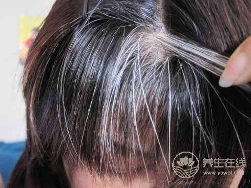 想要白發變黑發，需要做好5點