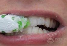 口臭太尷尬！做好三件事擺脫口臭困擾