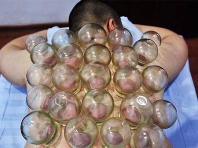 拔罐可以起到補(bǔ)腎的效果嗎 想要補(bǔ)腎應(yīng)該吃什么