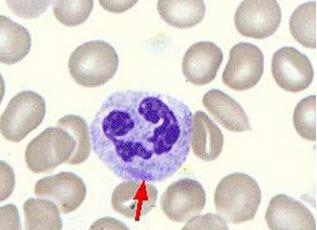 吃什么食物可以讓白細胞更快的增殖 吃什么食物可以讓白細胞更快的增殖